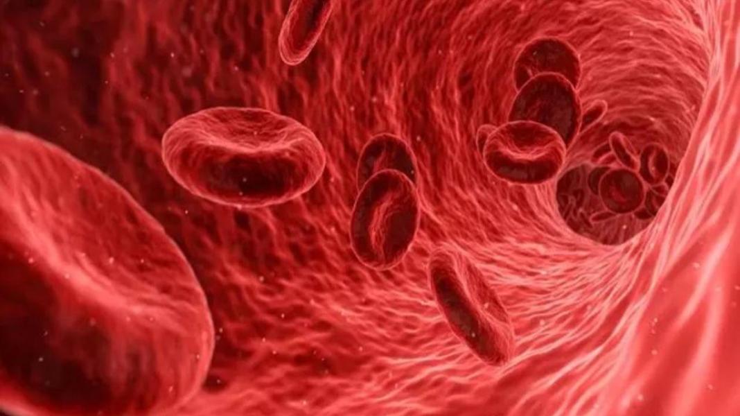 আয়রনের ঘাটতি কমাতে ডাল-দই-ছোলা খেতে বললেন কারিনার পুষ্টিবিদ