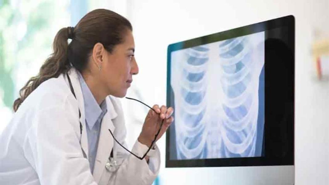 সংযুক্ত ছবি